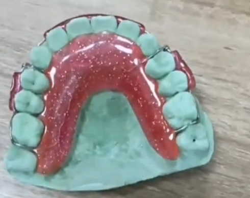 Acrylic Denture-thum2