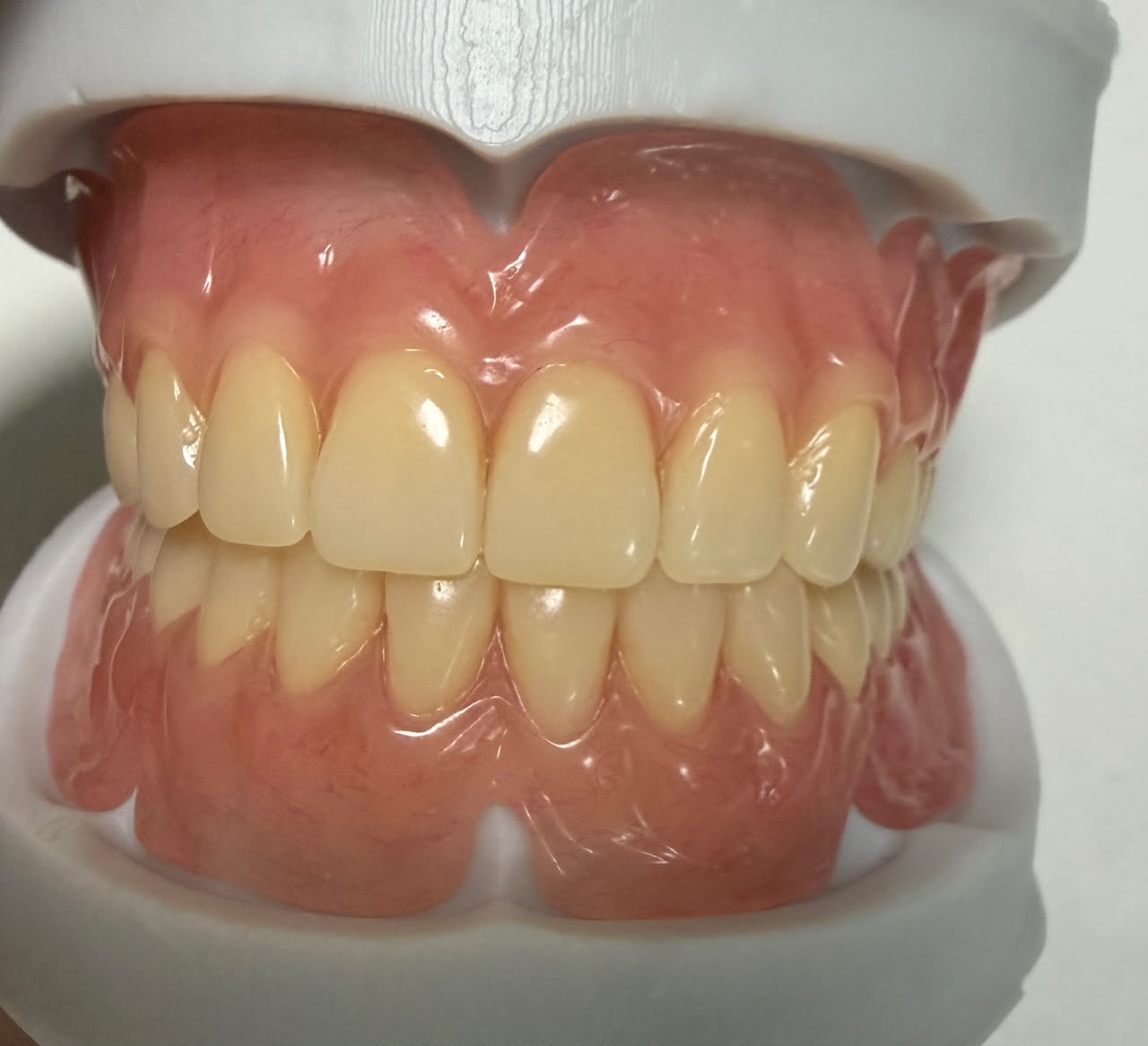 Denture flexible