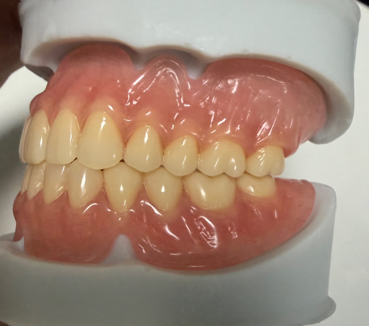 Denture flexible