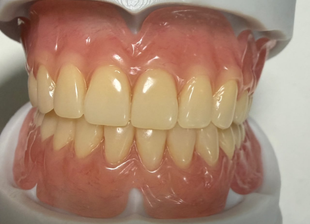 Denture flexxible