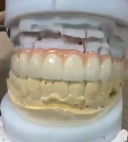 Full Contour Zirconia-1
