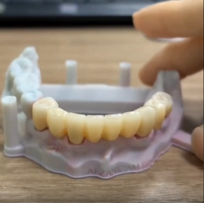 Full Contour Zirconia Bridge-thumb-2