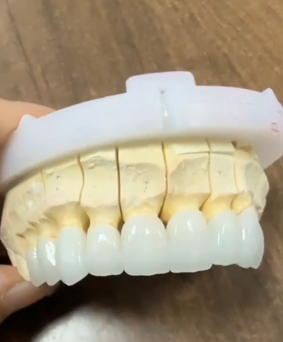 Full Contour Zirconia-thumb-2