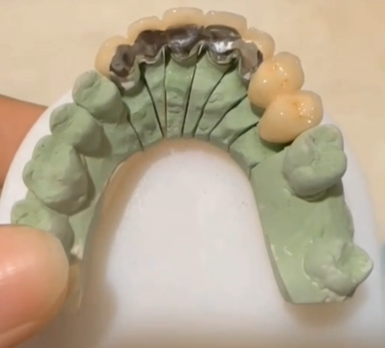 PFM Bridge-thumb-1
