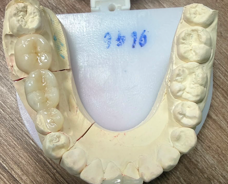 Precision-Zirconia-Milled-to-Fits